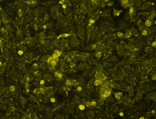 Immortalized Human Corneal Endothelial Cells