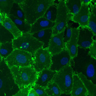 immortalized aortic endothelial cells