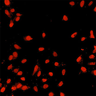 sertoli cells