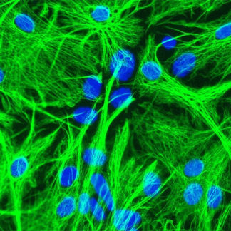 mouse astrocytes