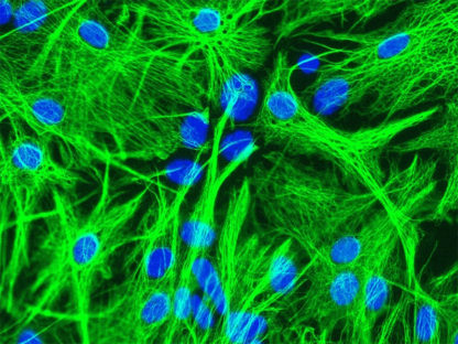 mouse astrocytes