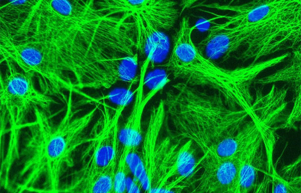 Mouse Astrocytes