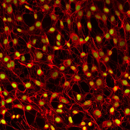 Human Dural Fibroblasts 1