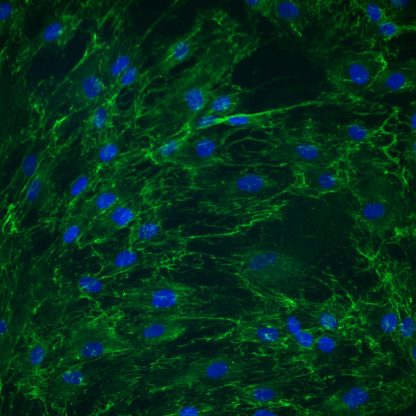 Gingival Fibroblasts