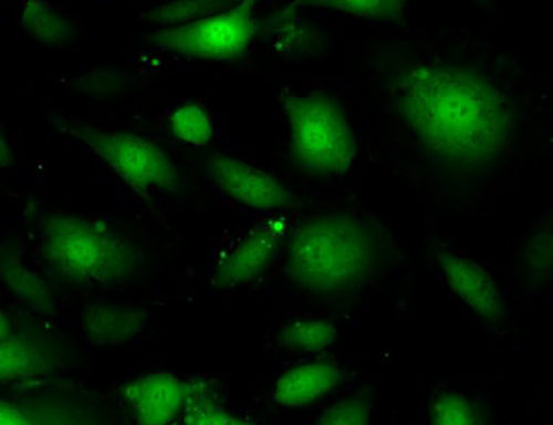Green Fluorescent Human Colonic Microvascular Endothelial Cells