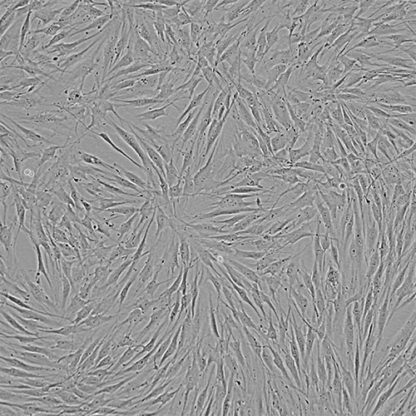 Immortalized Gingival Fibroblasts