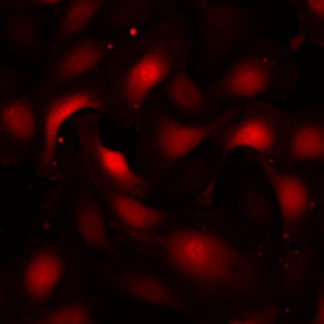 Fluorescent Colonic Microvascular Endothelial Cells