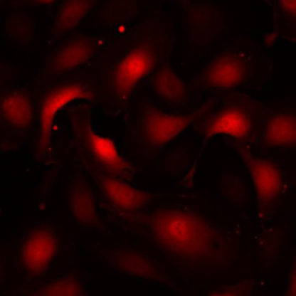 Fluorescent Colonic Microvascular Endothelial Cells