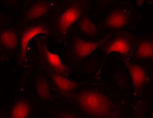 Red Fluorescent Human Colonic Microvascular Endothelial Cells
