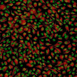 Human Gastric Epithelial Cells