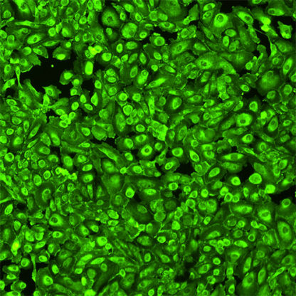 human podocytes GFP