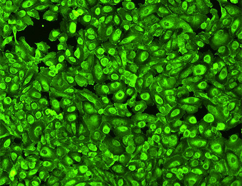 Green Fluorescent Human Kidney Podocytes