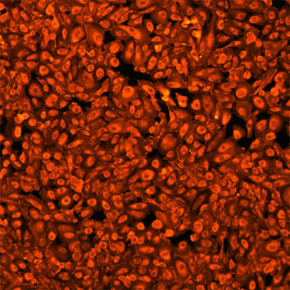 human podocytes RFP