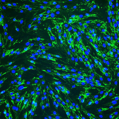 Immortalized Colonic Fibroblasts