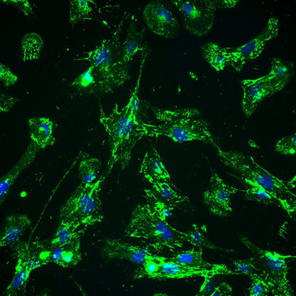 Immortalized Small Intestine Fibroblasts