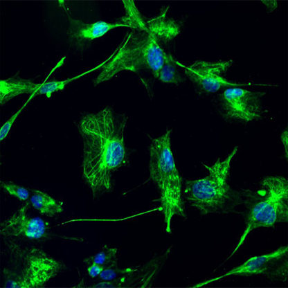 Immortalized Human Small Intestine Fibroblasts