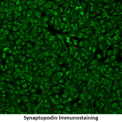 Immortalized Kidney Podocytes