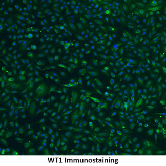 Immortalized Human Kidney Podocytes