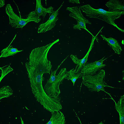 immortalized meningeal cells