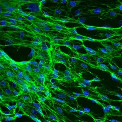 Human Splenic Fibroblasts