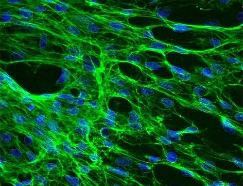 Human Splenic Fibroblasts