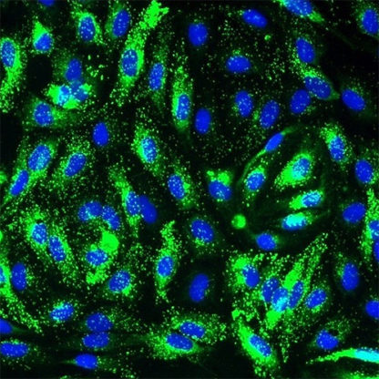 Human Splenic Endothelial Cells