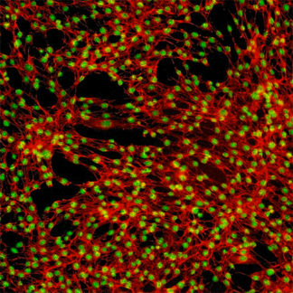 Human Tonsil Fibroblasts