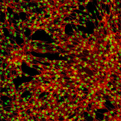 Human Tonsil Fibroblasts