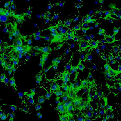 Human Thyroid Fibroblasts