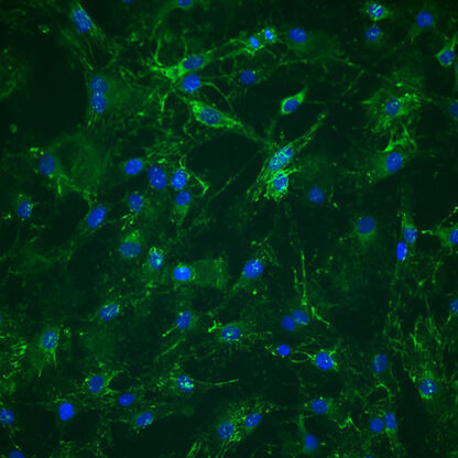 Immortalized Human Synoviocytes - Fibronectin