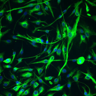 Immortalized Human Synoviocytes - Vimentin