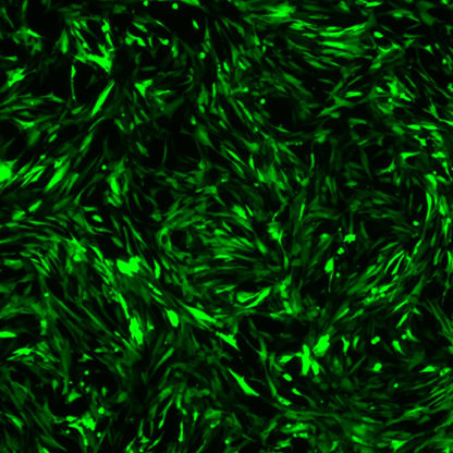 Green Fluorescent Immortalized Human Astrocytes