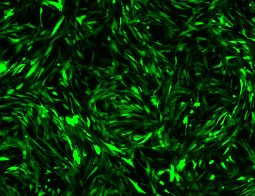 Green Fluorescent Immortalized Human Astrocytes