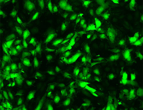 Green Fluorescent Immortalized Human Aortic Endothelial Cells