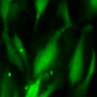 Immortalized Human Dermal Microvascular Endothelial Cells