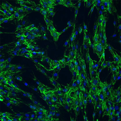 Immortalized Hepatic Stellate Cells