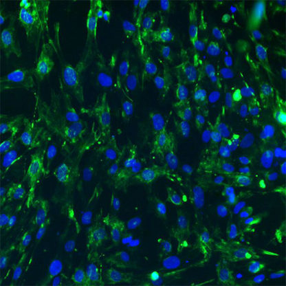 Immortalized Human Hepatic Stellate Cells