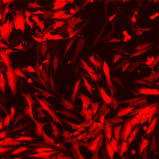 Red Fluorescent Immortalized Human Colonic Fibroblasts