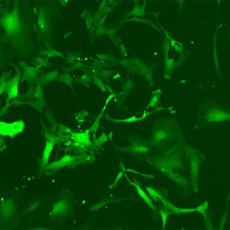 Green Fluorescent Human Primary Astrocytes