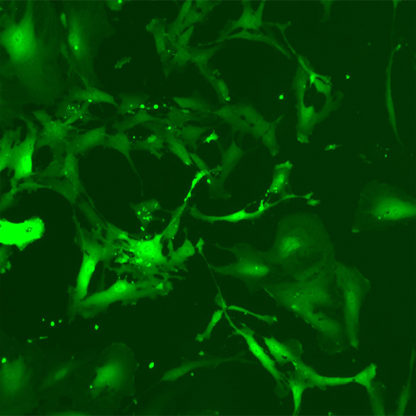 Green Fluorescent Human Primary Astrocytes