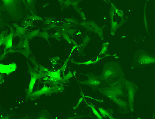 Green Fluorescent Human Primary Astrocytes