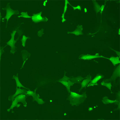 Fluorescent Human Astrocytes