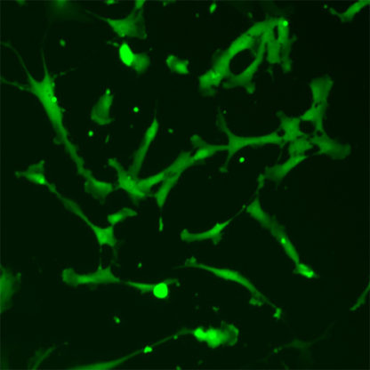 Green Fluorescent Human Astrocytes