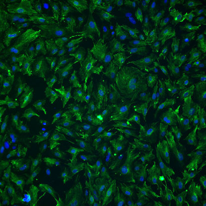 Immortalized Renal Mesangial Cells