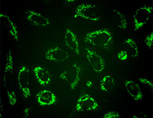 Green Fluorescent PINK1 Cell Line