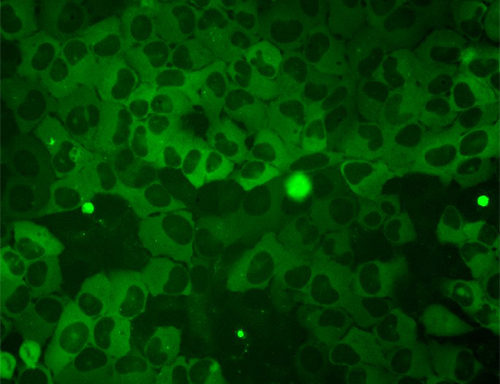 Green Fluorescent mutant HTT-92Q inducible Cell Line