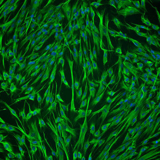 smooth muscle cells