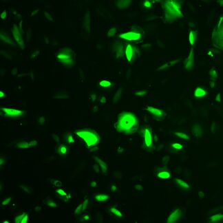 Green Fluorescent Human Kidney Podocytes