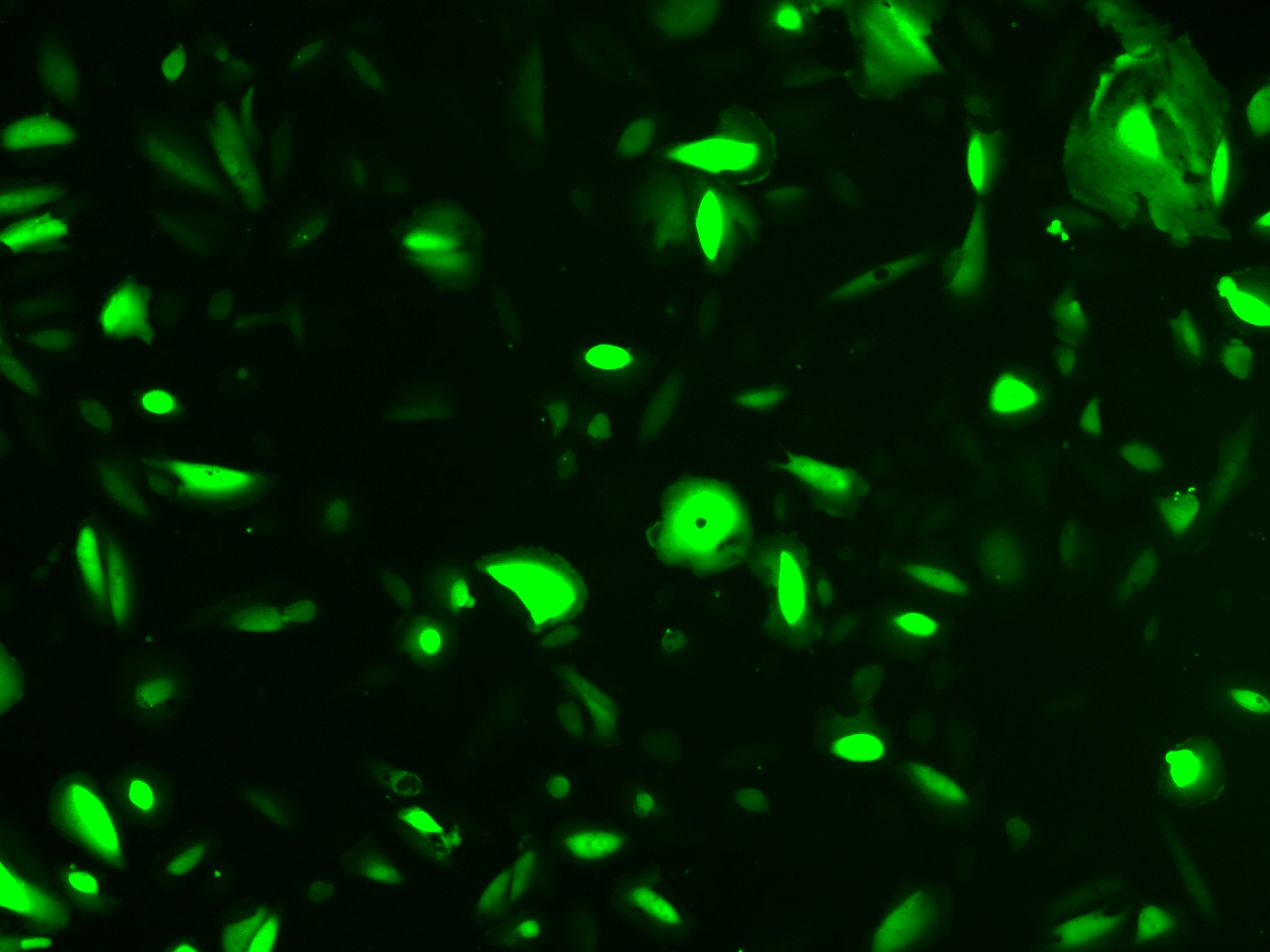 Green Fluorescent Human Kidney Podocytes
