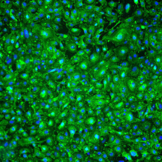 Immortalized Human Renal Glomerular Endothelial Cells